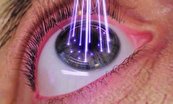 دستگاه یک میلیاردی «تصویربرداری لیزری از چشم» بومی‌سازی شد