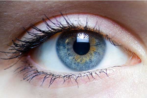 عوامل خطرساز جراحی چشم لیزیک و محدودیت‌های آن