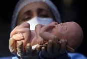 افزایش سقط‌ جنین در ایران به دلیل مسائل اقتصادی