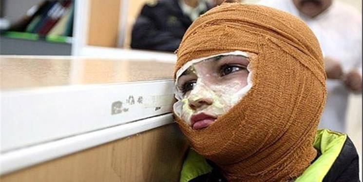 کمبود هزار تخت سوختگی در ایران و پوشش بیمه ای ضعیف به بهانه عمل زیبایی + عین الهی را ولش کن ، نهادهای خیریه ای دست بالا بزنند