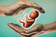 قرص سقط جنین مانند قرص استامینوفن در دسترس است