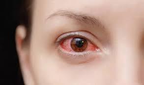 از بین رفتن قرنیه چشم تعدادی از بیماران به دلیل مصرف یک دارو