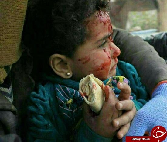 لقمه خون آلود کودک سوری