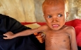 احتمال مرگ بیش از ۵۰ هزار کودک یمنی تا پایان سال ۲۰۱۷