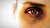 12 علت اصلی کبودی و سیاهی دور چشم و 16 روش درمان خانگی آن