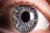 تاثیر نانولوله‌های زیستی در ایجاد برخی بیماری‌های چشم