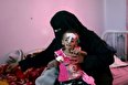 قحطی بزرگ در کمین میلیون‌ها انسان در یمن