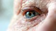 پیش‌بینی زودهنگام امکان ابتلا به آلزایم با معاینه چشم