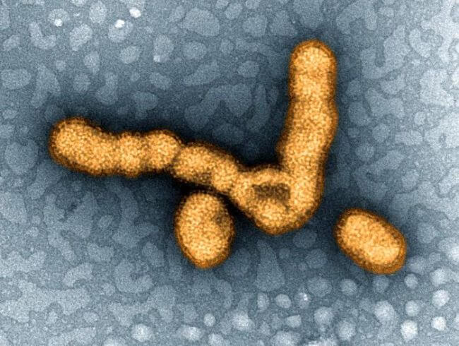 ویروس‌های ۱۲ گانه مرگبار روی زمین