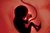ممنوعیت و مصائب سقط خودخواسته در ایران