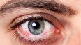 از عفونت تا کوری؛ عوارض شنا کردن با لنز‌های چشمی