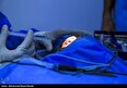انجام عمل تغییر رنگ چشم ممنوع است: کم اطلاعی بسیاری از جوانان با عوارض خطرناک تتوی قرنیه