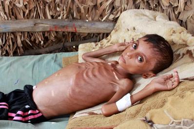 فاجعه انسانی در یمن
